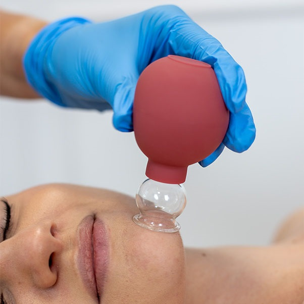 Masážní baňka s balónkem Acus Med 1,5 cm