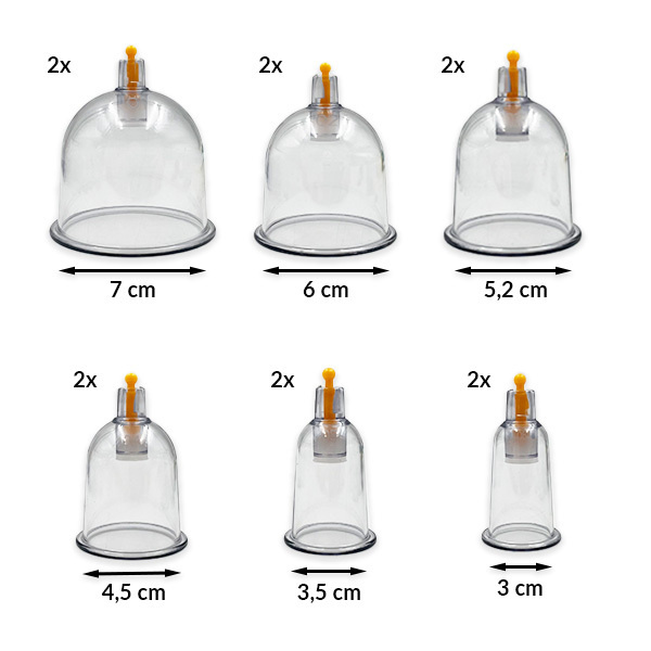 Vakuové baňky Acus Med s pumpičkou - sada 12 ks.